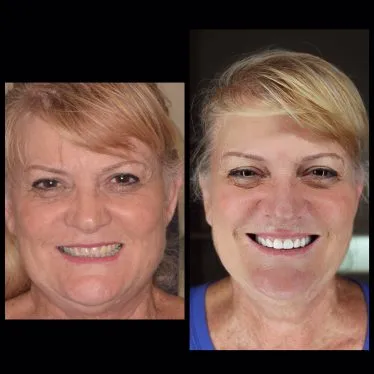 Case 5 full face before and after cosmetic treatment photos